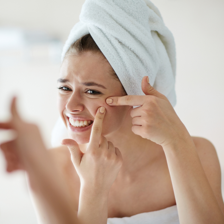 How To Break Free From Breakouts: Top tips + product picks for acne management