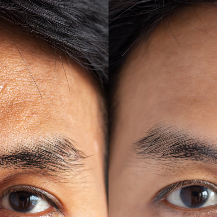 Facts About Skin Lighteners and Brighteners