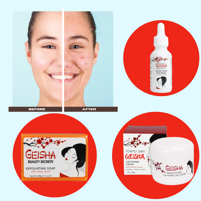 All About Kojic Acid: The Brightening Beauty Ingredient You Need in Your Skincare Toolkit
