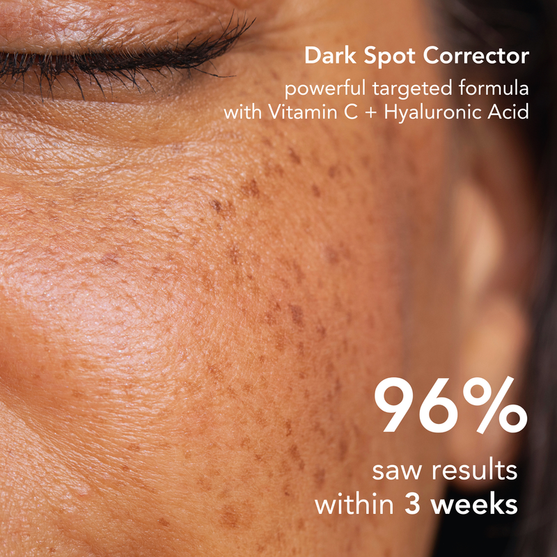 Neoprosone 20% Vitamin C Dark Spot Corrector Cream 1 fl oz / 30ml - Mitchell Brands