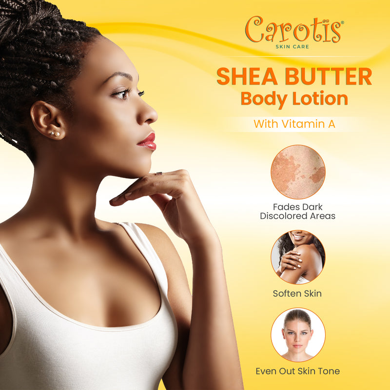 Carotis Brightening Shea Butter Body Lotion with Vitamin A - 500ml / 17.6 fl oz Mitchell Brands - Mitchell Brands - Skin Lightening, Skin Brightening, Fade Dark Spots, Shea Butter, Hair Growth Products