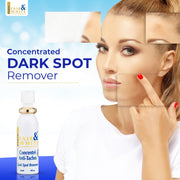 Fair & White Original Dark Spot Remover - For Soft and Radiant Skin - 30ml / 1 fl oz Fair & White - Mitchell Brands - Skin Lightening, Skin Brightening, Fade Dark Spots, Shea Butter, Hair Growth Products