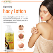 Carotis Bundle Mitchell Brands - Mitchell Brands - Skin Lightening, Skin Brightening, Fade Dark Spots, Shea Butter, Hair Growth Products