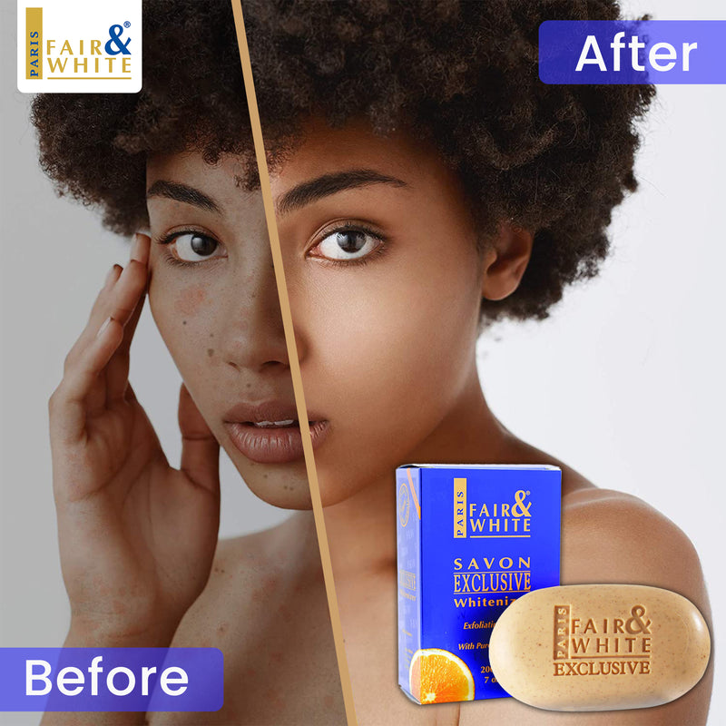 Fair & White Exclusive Exfoliating Soap with Pure Vitamin "C" - Fades Dark Spots - 200g / 7 oz Fair & White Exclusive - Mitchell Brands - Skin Lightening, Skin Brightening, Fade Dark Spots, Shea Butter, Hair Growth Products