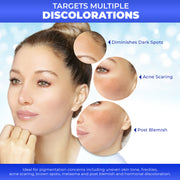 Fair & White Original Dark Spot Remover Soft Radiant Skin