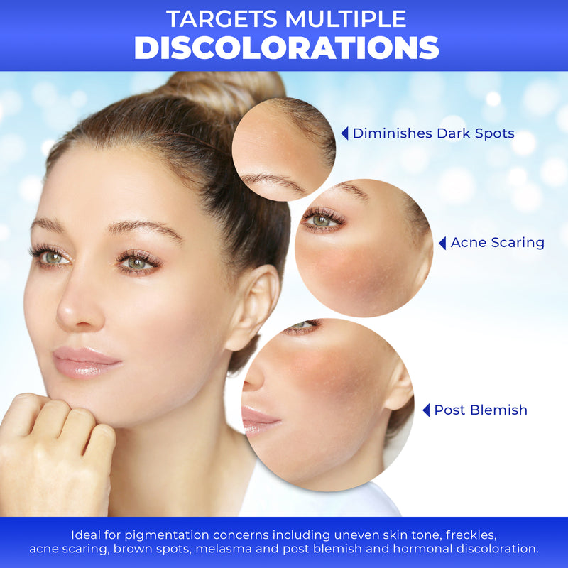 Fair & White Original Dark Spot Remover Soft Radiant Skin