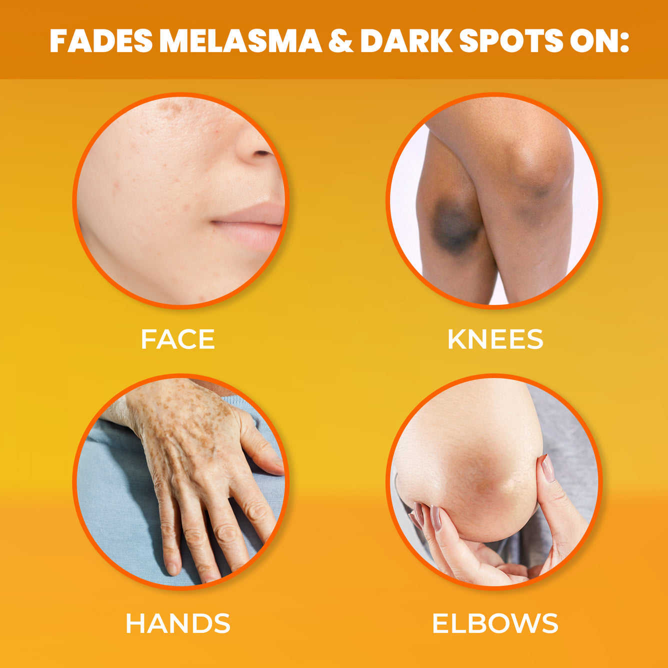 New York Bright & Lovely Vitamin C Serum 30ml Mitchell Group USA, LLC - Mitchell Brands - Skin Lightening, Skin Brightening, Fade Dark Spots, Shea Butter, Hair Growth Products