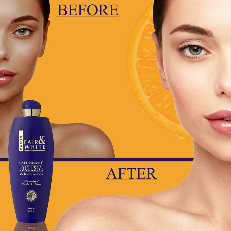 Fair & White Exclusive Body Lotion with Pure Vitamin "C" - Radiant Skin - 500ml / 17 fl oz Fair & White Exclusive - Mitchell Brands - Skin Lightening, Skin Brightening, Fade Dark Spots, Shea Butter, Hair Growth Products