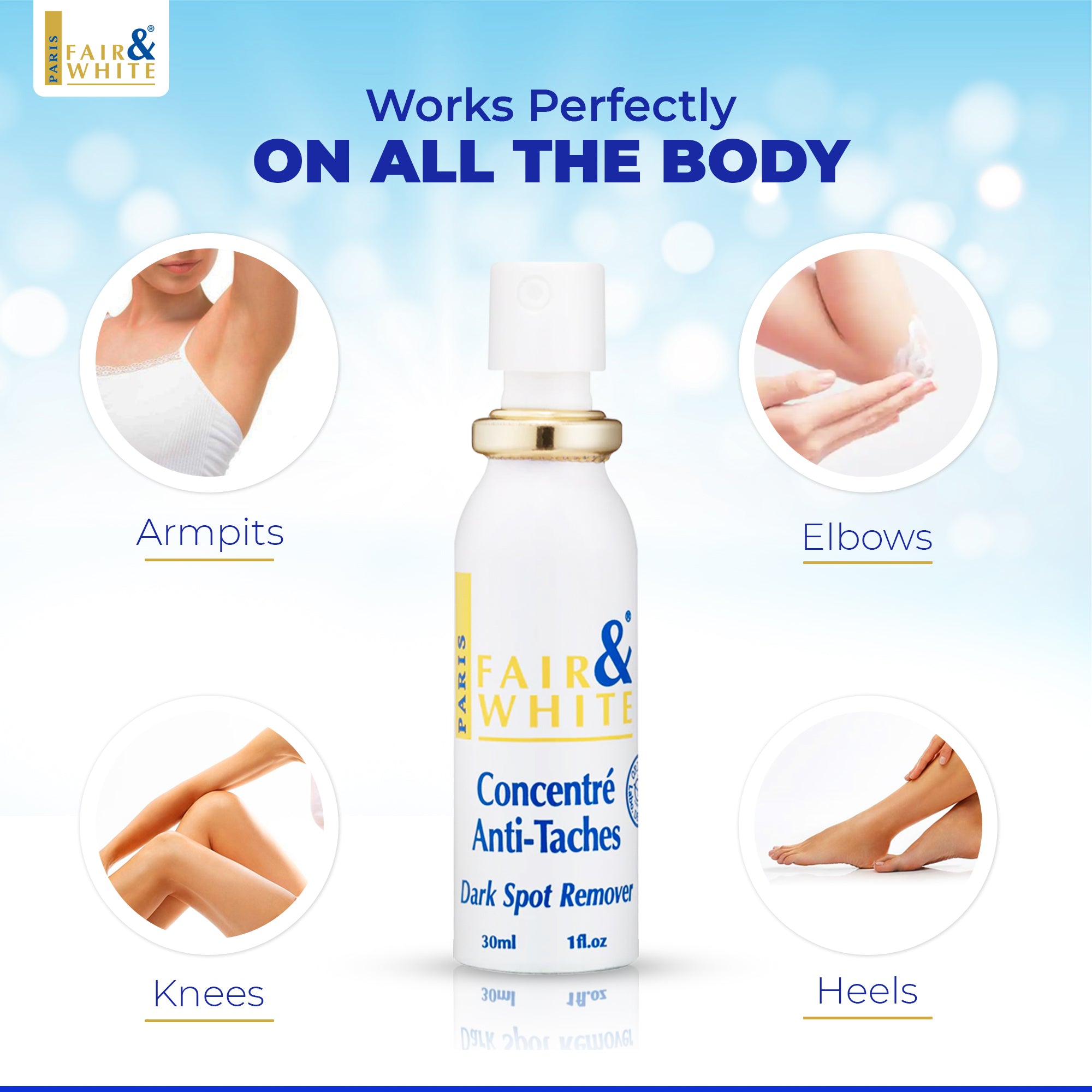 Fair & White Original Dark Spot Remover, 30ml | Mitchell Brands