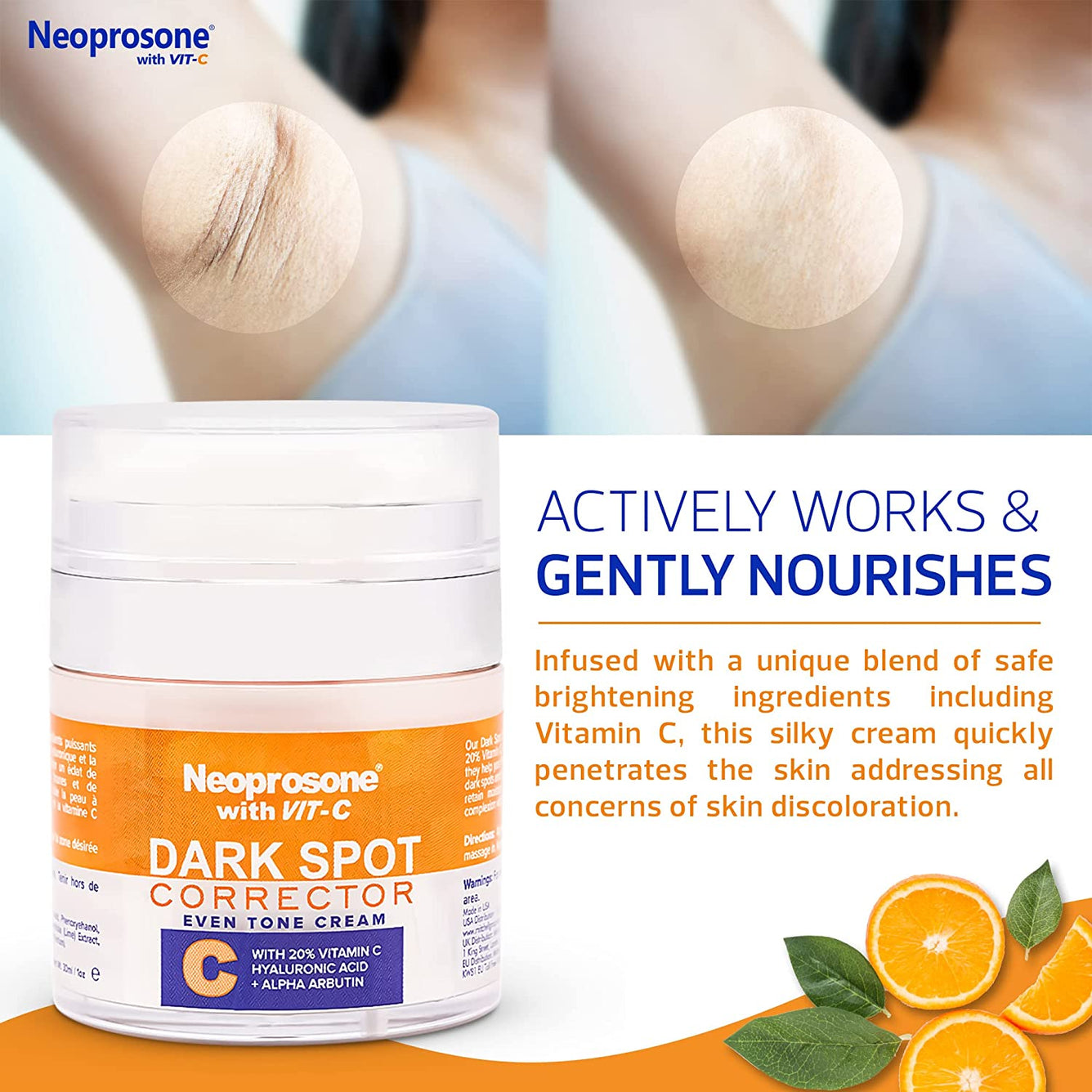 Neoprosone 20% Vitamin C Dark Spot Cream 30ml Mitchell Brands - Mitchell Brands - Skin Lightening, Skin Brightening, Fade Dark Spots, Shea Butter, Hair Growth Products
